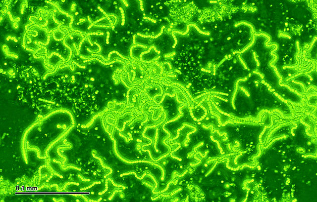 640px-cyanobacteria_248_08_mixture3b_native_preparation3b_green_filter